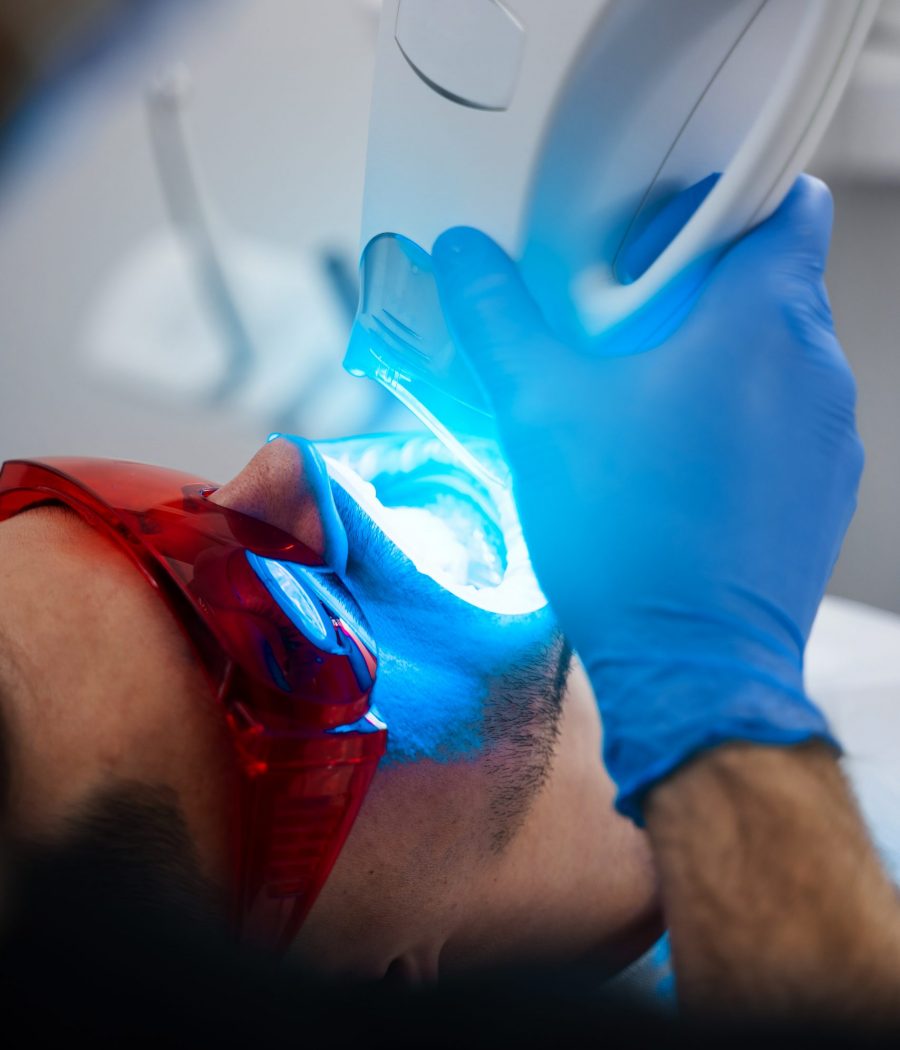 Dental whitening procedure by ultraviolet light. Patient whitens his teeth wearing goggles and lip retractor. Professionelle Zahnaufhellung Pforzheim
